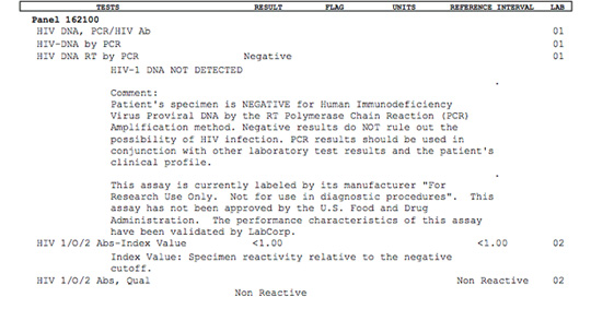 Hiv Antibody